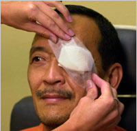 Glaucoma